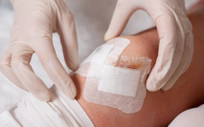 5 Signs a Wound Needs a Skilled Nurse