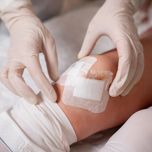5 Signs a Wound Needs a Skilled Nurse